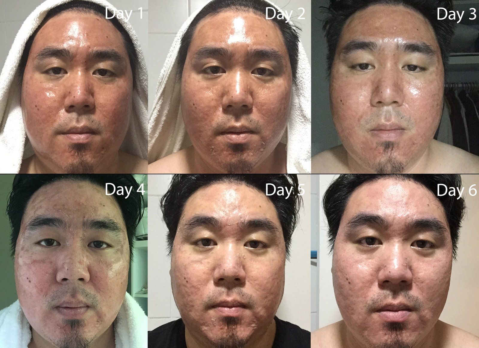 daily progress