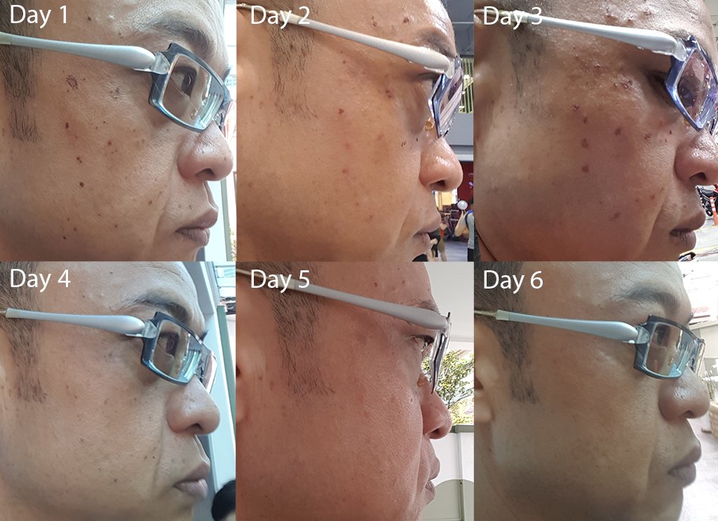 daily progress