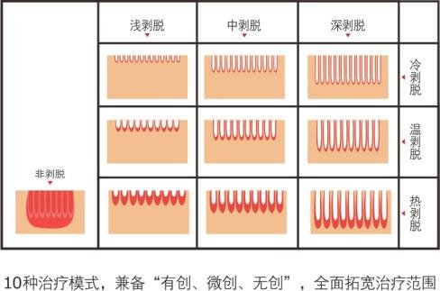 er yag mode in chinese