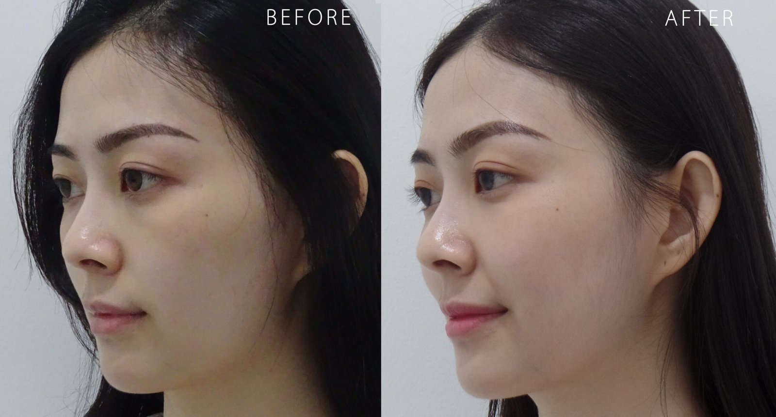 filler dec & cheek 02.jpg