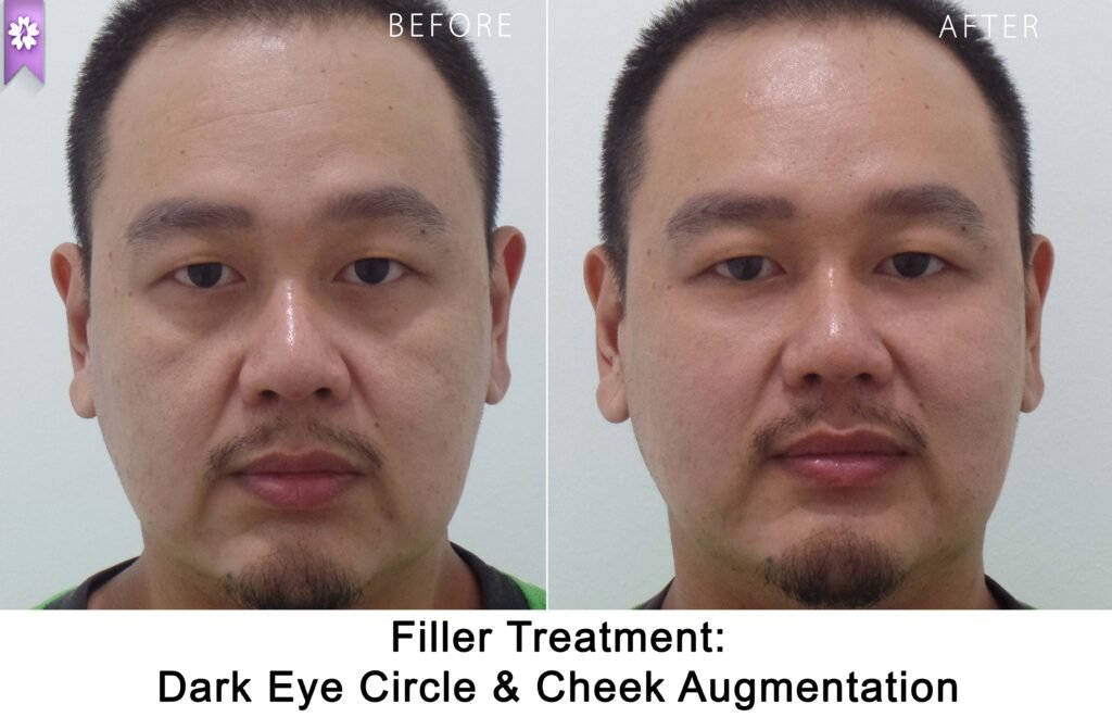 个别患者的治疗前后对比照片
