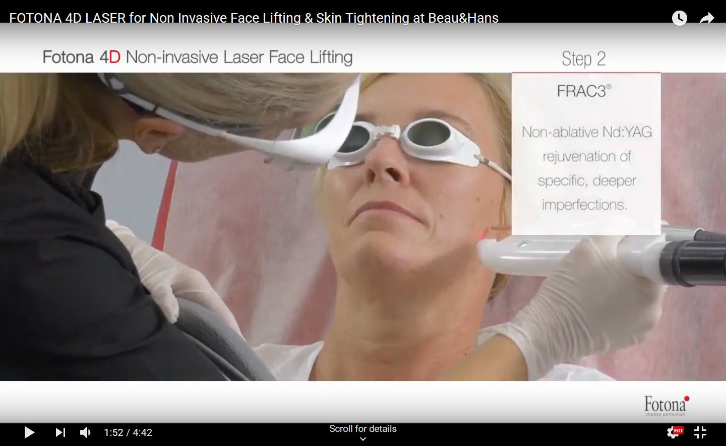 fotona 4D video