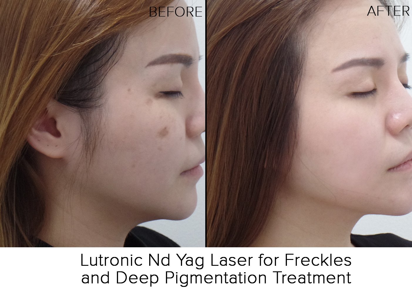 right before after resize